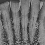 Anthropology faculty member, student use emerging technique to determine age of skulls